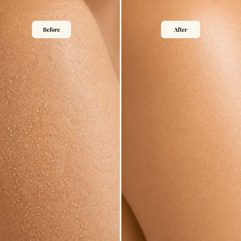 mireli naturals before and after comparison image for dry skin